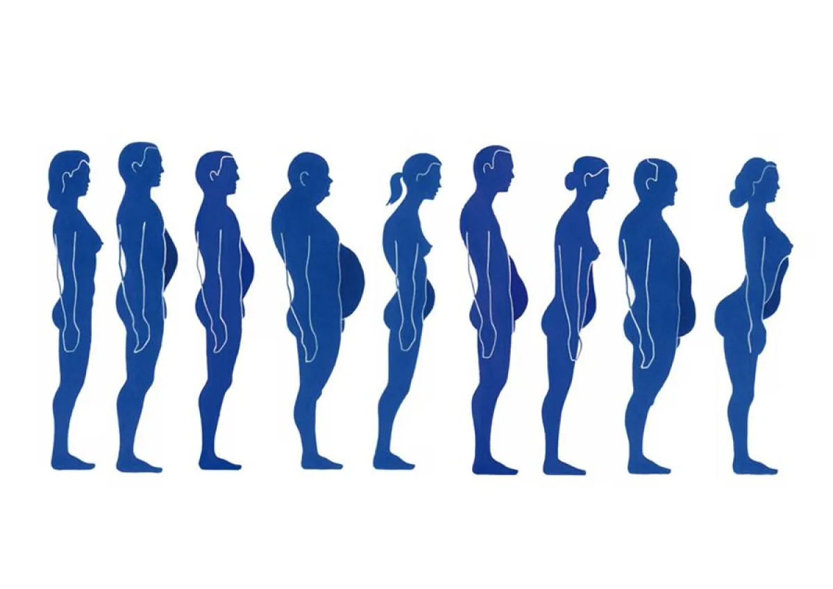 Teil der Diagnosestellung nach F. X. Mayr: Die Bauchformanalyse