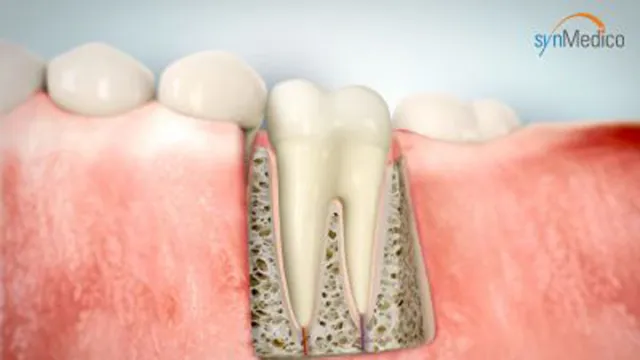 Bild: Die Endodontie - ein unterschätzter Bereich der Zahnmedizin, der (Zahn) Leben retten kann.