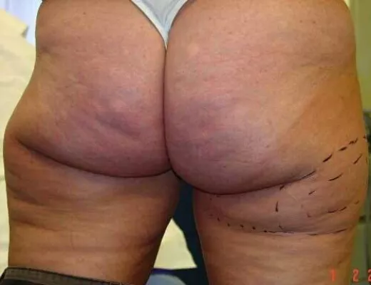 Wer schoen sein will geht zum Chirurgen Bild: Wer schoen sein will geht zum Chirurgen