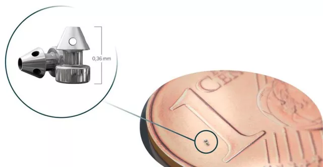 Bild: Faszinierende Technik: Innovative „Grüner Star“-Behandlung mit Mini-Implantat