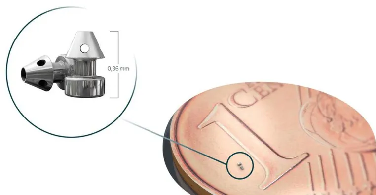 Bild: Faszinierende Technik: Innovative „Grüner Star“-Behandlung mit Mini-Implantat