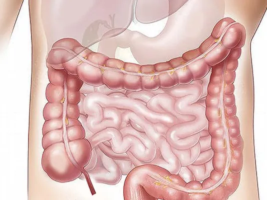Bild: Mehr Ballaststoffe bei Divertikelkrankheit