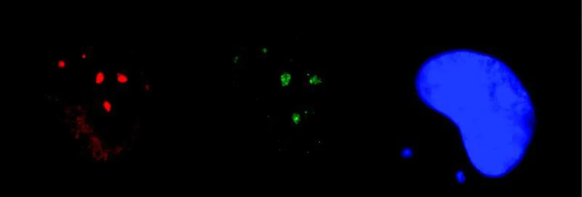 Visualisierung der DNA-Reperaturproteine XPC (grün) und MUTYH (rot) an Orten mit UV-induziertem DNA-Schaden im Zellkern (blau) einer menschlichen Zelle (CeMM/Abdelghani Mazouzi)