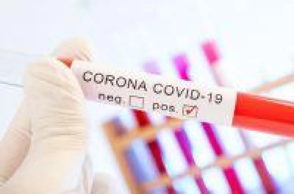 Covid 19 Test jetzt in vollautomatischen Laboren möglich