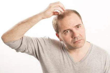 Bild: Was tun gegen Haarausfall? - Haarausfall wirksam bekämpfen