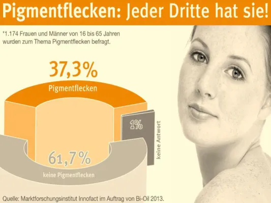 Bild: Aktuelle Umfrage: Jeder zehnte Deutsche stört sich an Sommersprosse und Co