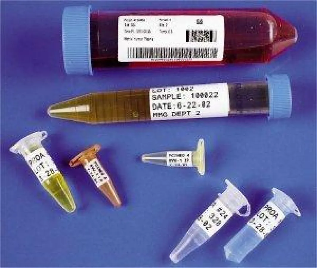 Mit Laserdrucker gedruckete Laboretiketten