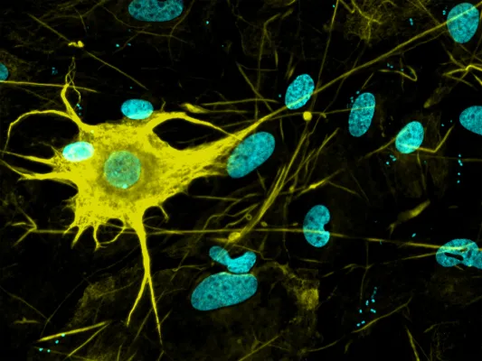 Bild: Sehr viel mehr als zuvor – über 400 unterschiedliche Typen von Nervenzellen erzeugt