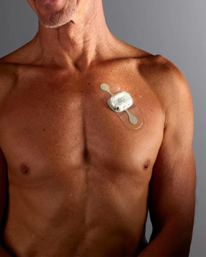 Für die EKG-Aufzeichnung wird ein Pflaster mit integrierter Aufzeichnungseinheit auf die Brust der Patienten geklebt.  (Quelle: iRhythm Technologies)