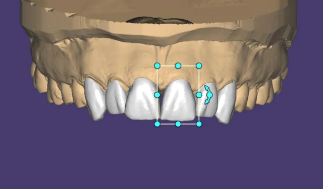 Bild: Smile Creator – Die revolutionäre in-CAD Smile Design Lösung