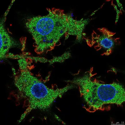 Bild: Wie Urbakterien Entzündungsreaktionen auslösen können