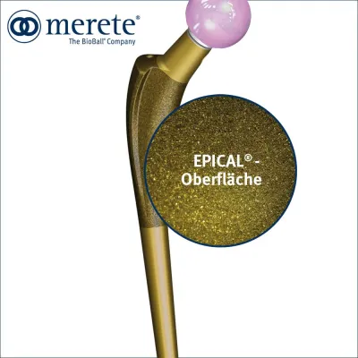 Bild: EPICAL® - Das neue Verfahren zur Behandlung von Titanimplantaten stimuliert das Knochenwachstum positiv