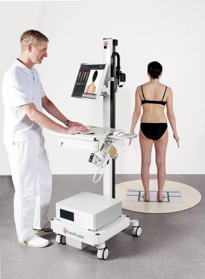 Hautkrebsuntersuchung mit ATBM-Technologie von FotoFinder