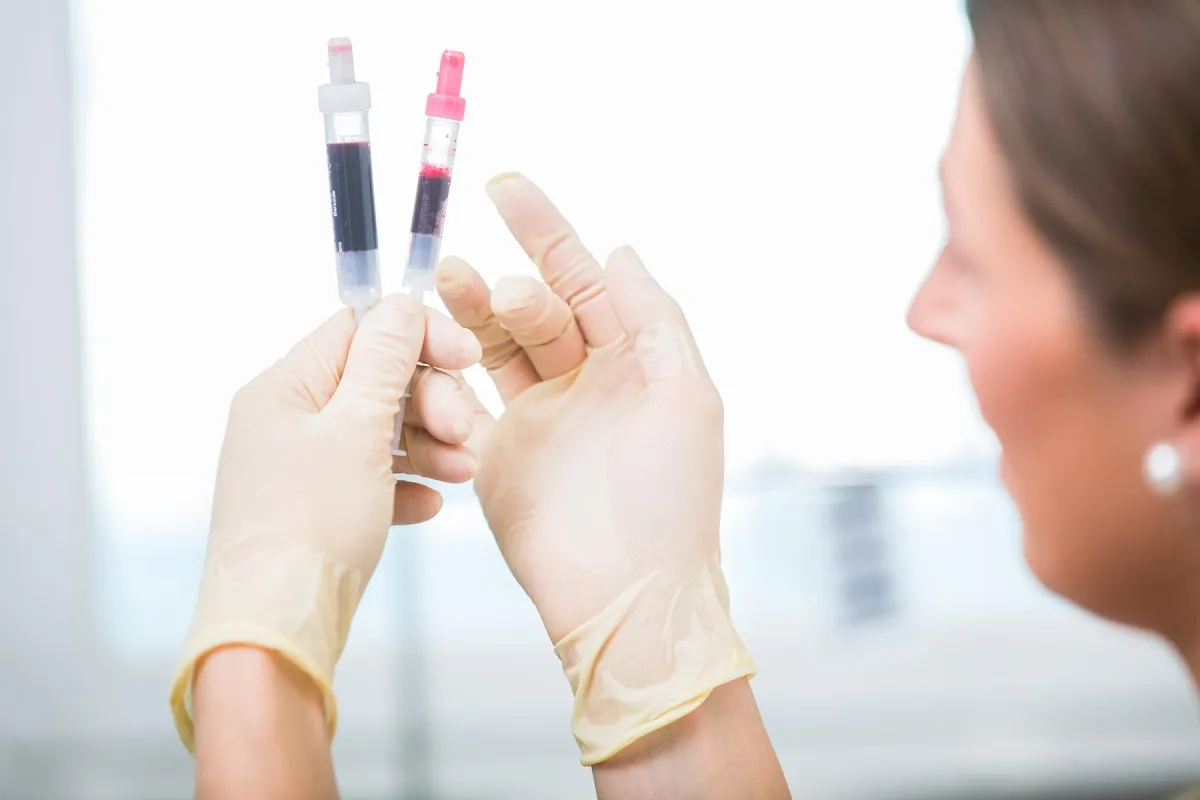 Blut sparen im Krankenhaus durch PBM. © Ramona Ott