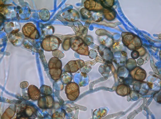 Schimmelpilze im Bioabfall Bild: Schimmelpilze im Bioabfall