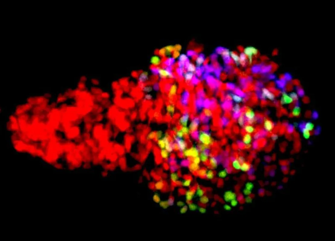Zebrafish ?-cells labeled using the Beta-bow system through the combinatorial expression of fluorescent proteins, allowing the developmental history of ?-cells to be traced during islet growth. (© Nin
