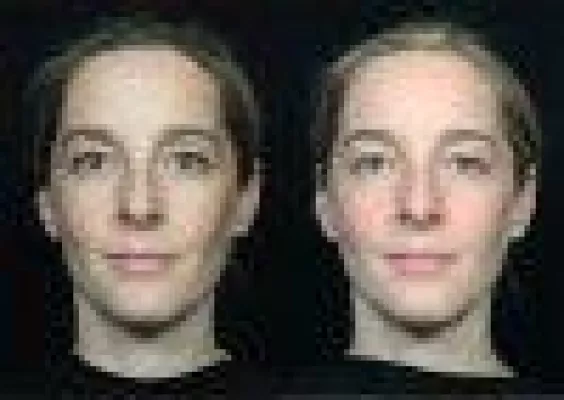 Bild: Der Schlüssel zur Schönheit: Makellose Haut