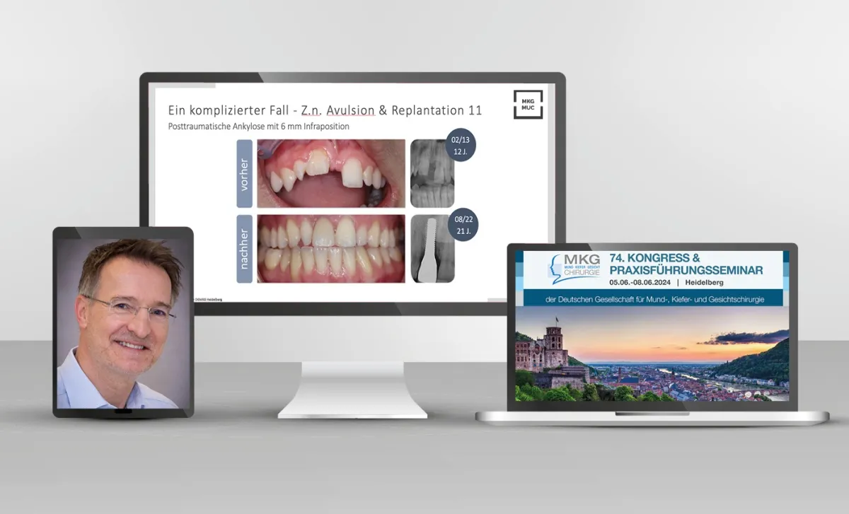 Prof. Dr. Dr. Dirk Nolte hält erneut Vortrag zu Dentalem Trauma - Fachkongress der DGMKG, Heidelberg (© mkg-muc)