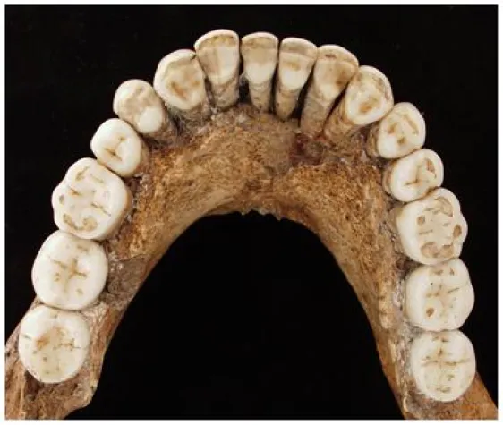 Das geht doch mit rechts. Zähne entlarven Neandertaler als Rechtshänder Bild: Das geht doch mit rechts. Zähne entlarven Neandertaler als Rechtshänder
