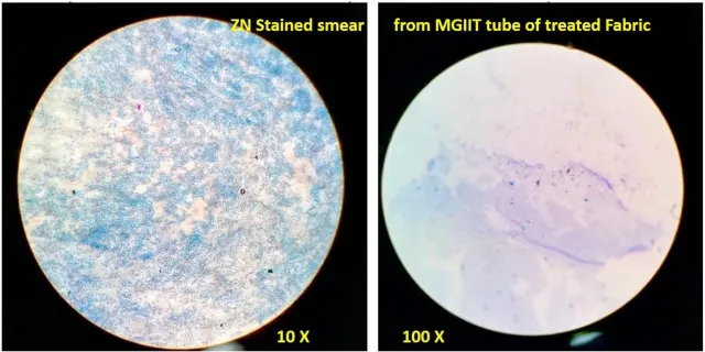 Bild: Labortests zeigen: Livinguard ist wirksam gegen Tuberkulose