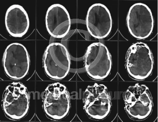 DIN - Format - Tabellen für Bildverwender und die Druckvorstufe Bild: DIN - Format - Tabellen für Bildverwender und die Druckvorstufe