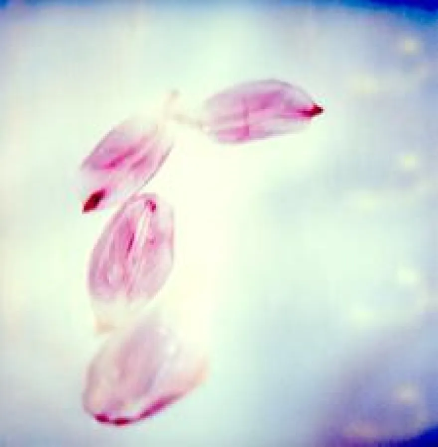 KUNSTBAR Limited Edition, Jennifer Rumbach