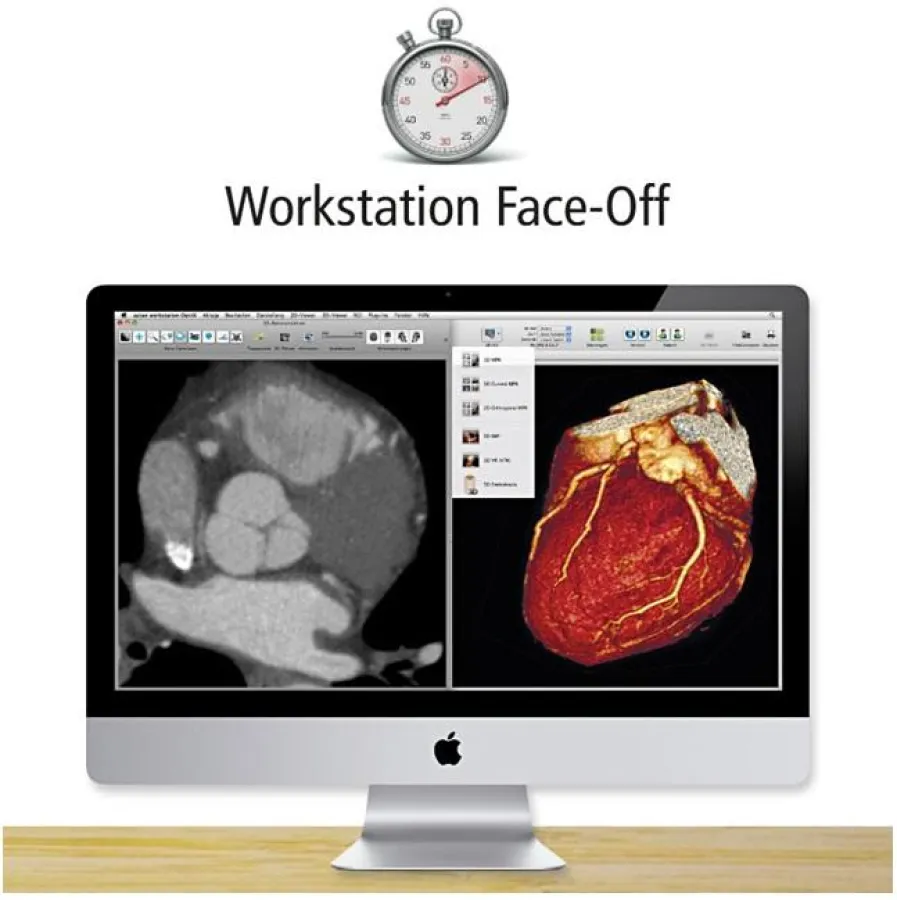 aycan OsiriX PRO am Face-Off - Darstellung von Cardio-CT in 2D und 3D