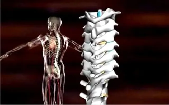 Bild: In "Neues aus der Medizin" haben die Zuschauer das Thema "Wirbelsäulenchirurgie" gewählt