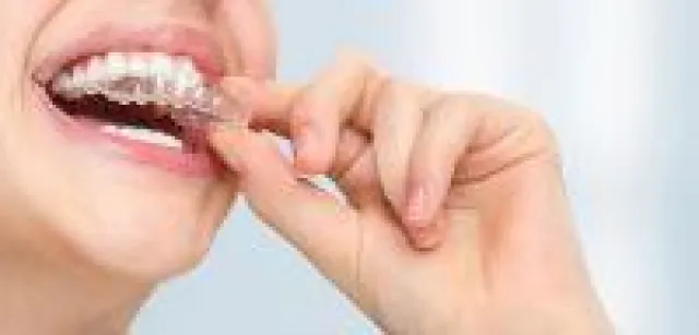 Bild: Neuer Zertifikatskurs "Kieferorthopädischer Aligner" an der DTMD University