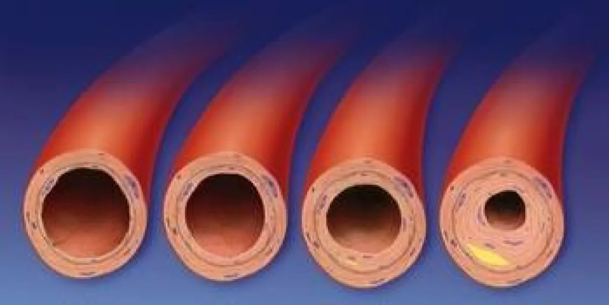 Mikronährstoffe sind wichtige Biomoleküle im Schutz gegen Atherosklerose  Bild: lom123, fotolia.de