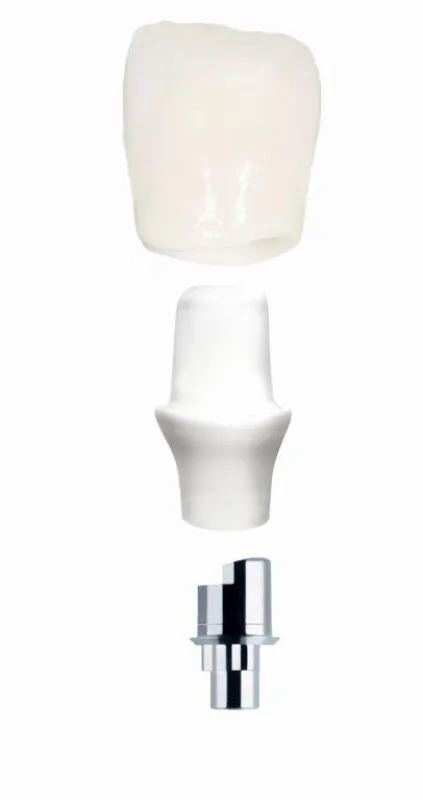 Zirkonoxidkrone mit naturgetreuem Emergenzprofil