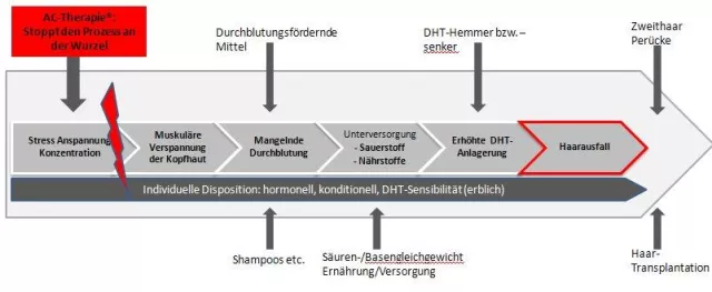 Bild: Erfolgreiche Therapie gegen erblich bedingten (androgenetischen) Haarausfall