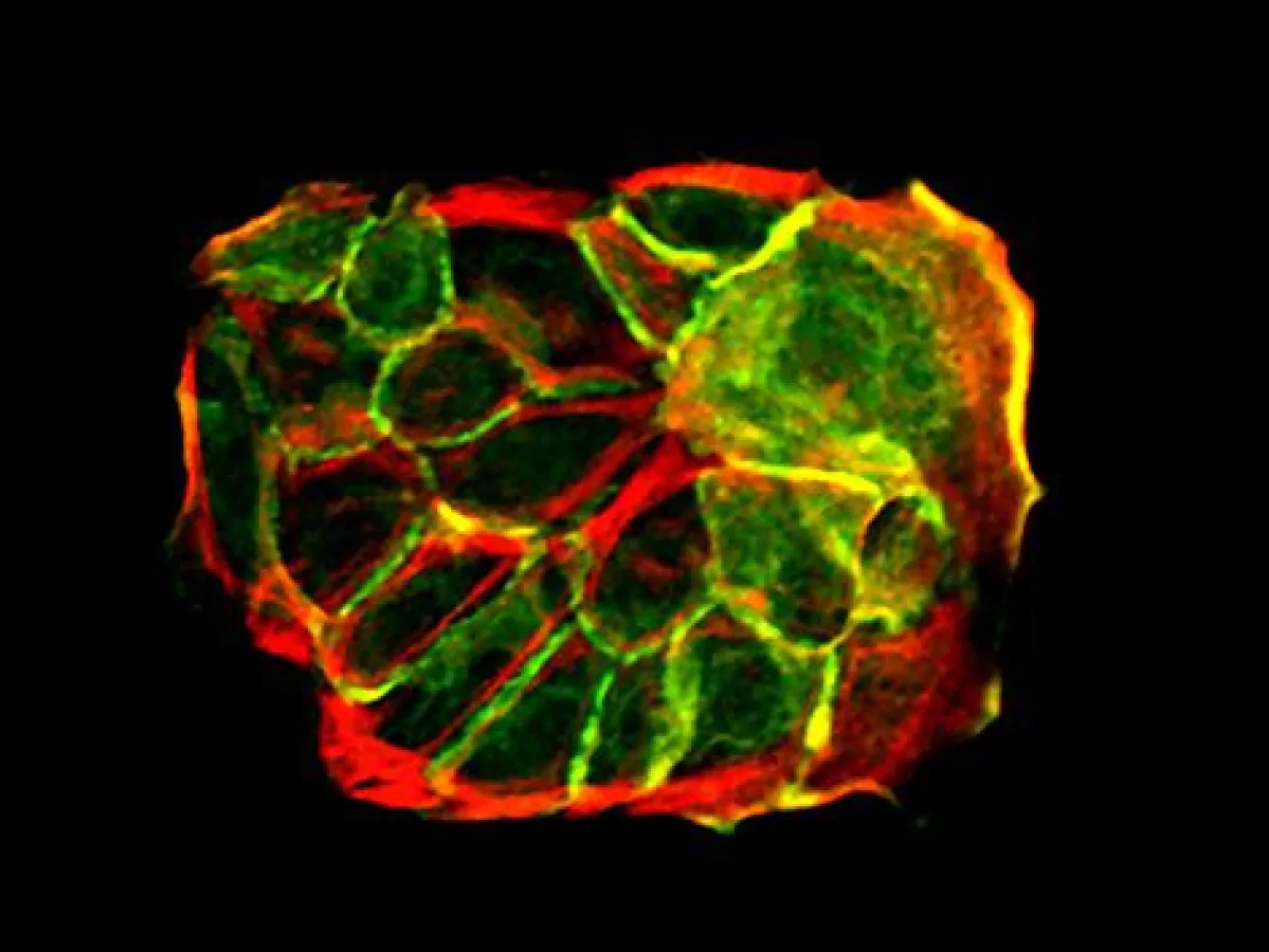 Lichtmikroskopische Aufnahme von Hautzellen in der Petrischale. Die Abbildung zeigt das Zytoskelett der Zellen in grün und ein Zell-Zell-Verbindungsprotein in rot. (Max-Planck-Institut für Biologie de