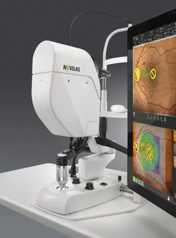 Welcome to the age of smart laser - Das revolutionäre Navilas® Laser System 577s Bild: Welcome to the age of smart laser - Das revolutionäre Navilas® Laser System 577s