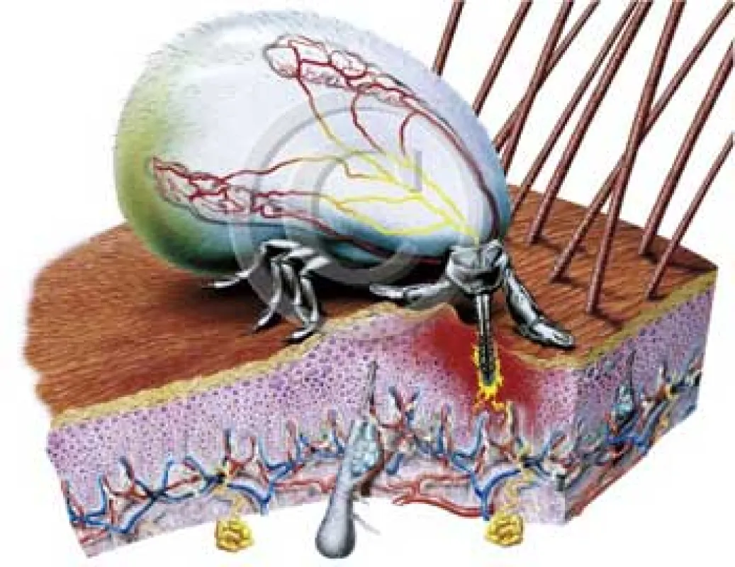 Zecke mit Saugrüssel, medicalpicture