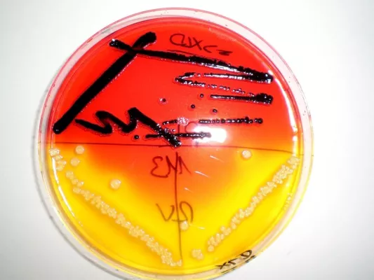 Bild: Lebensmittelbiotechnologie für mehr Lebensmittelsicherheit