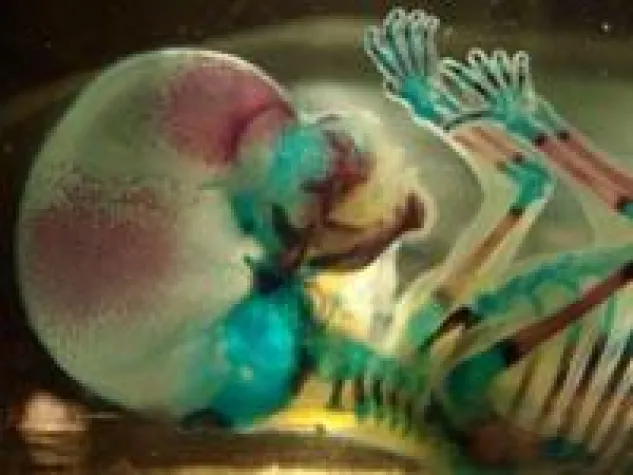 Bild: WissenSchafftBilder 2008 - die Preisträger