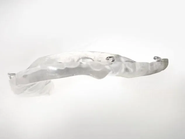 Bild: Wenn der Biss nicht stimmt: CMD und DROS®-Schienentherapie