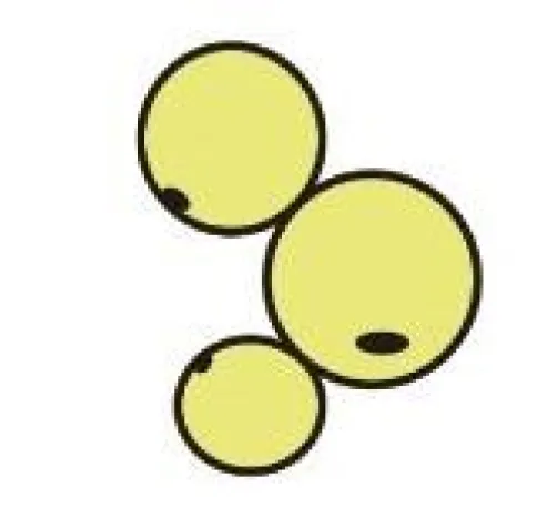 Bild: Think big - Plädoyer gegen eine Politik der kleinen Schritte im Kampf gegen die weltweite Adipositasepidemie