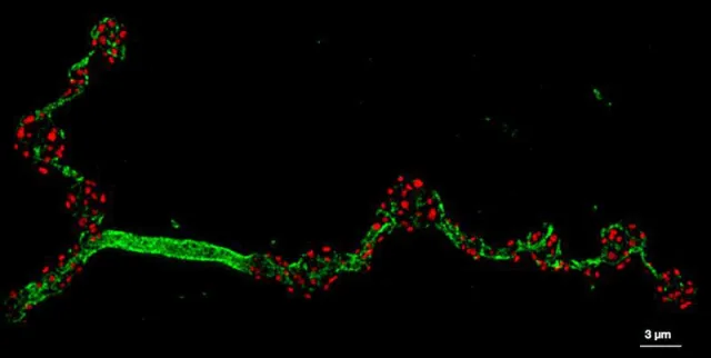 Bild: Neue Stiftungsprofessur für Nanophysiologie: Der zellulären Ordnung auf der Spur