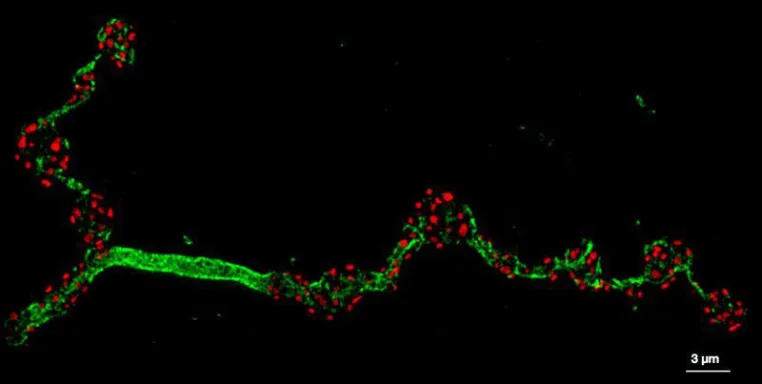 Neue Stiftungsprofessur für Nanophysiologie: Der zellulären Ordnung auf der Spur Bild: Neue Stiftungsprofessur für Nanophysiologie: Der zellulären Ordnung auf der Spur