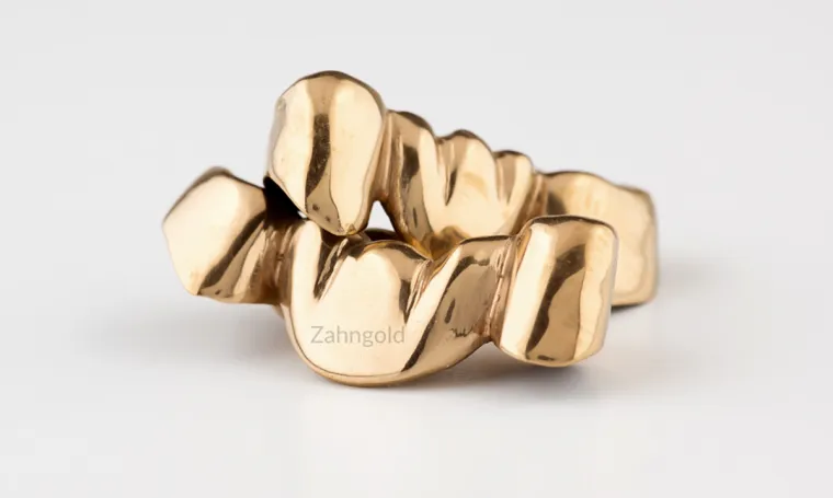 Bild: Berliner Ankäufer von Zahngold in 2023