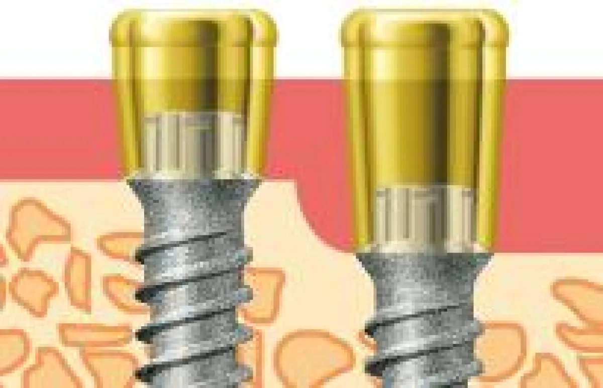 miniSKY Locator® zur Fixierung von Prothesen