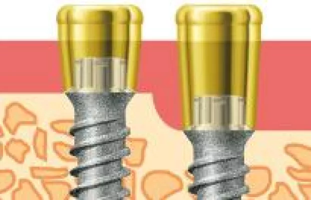 miniSKY Locator® – zuverlässig und minimalinvasiv Bild: miniSKY Locator® – zuverlässig und minimalinvasiv