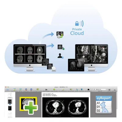 Bild: aycan veröffentlicht Update für die aycan OsiriX Workstation