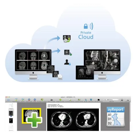 Bild: aycan veröffentlicht Update für die aycan OsiriX Workstation