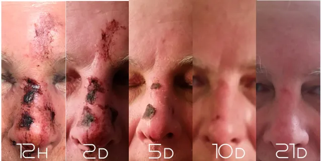 Bild: Aua – sieht schlimmer aus, als es ist