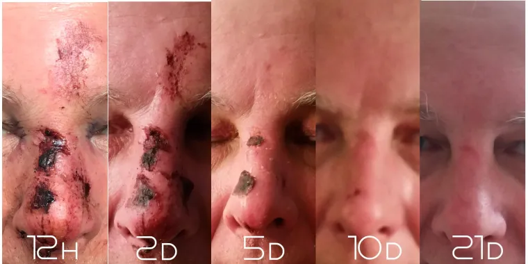 Aua – sieht schlimmer aus, als es ist Bild: Aua – sieht schlimmer aus, als es ist