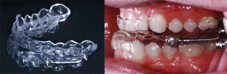 Gesund Schlafen – Schnarchen kann gefährlich sein Bild: Gesund Schlafen – Schnarchen kann gefährlich sein