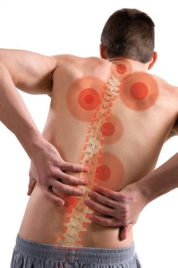 Rückenprobleme sind weit verbreitet